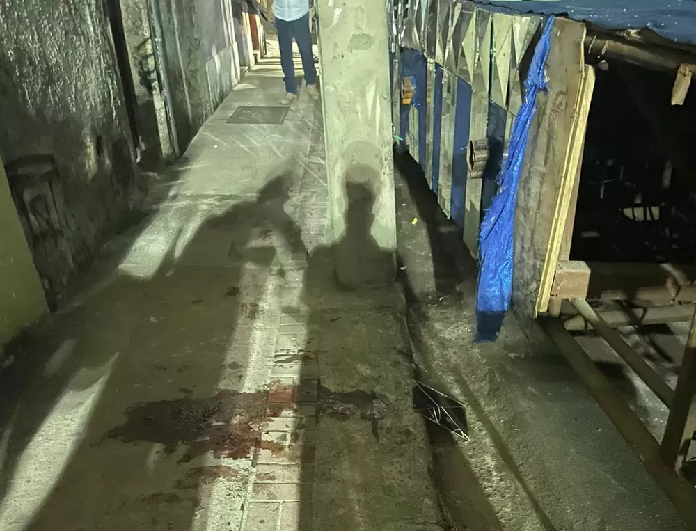 Menina de 11 anos perde a perna em acidente com carro alegórico.